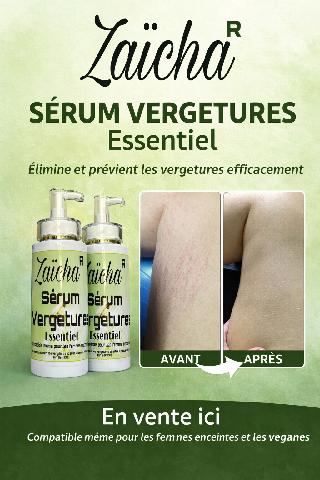 Vergeture solution